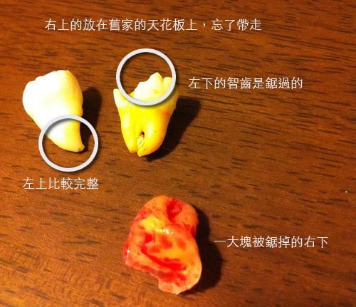 智齒